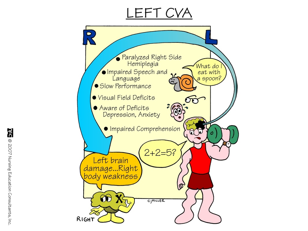 Left Cva Vs Right Cva Chart